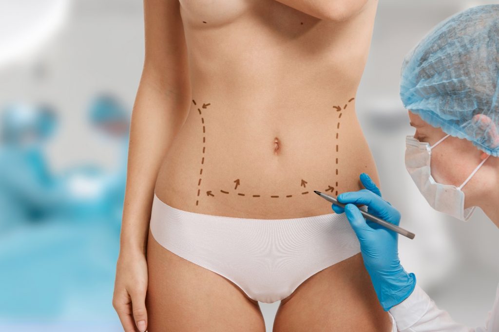 3 conseils pour réduire le gonflement d’une abdominoplastie